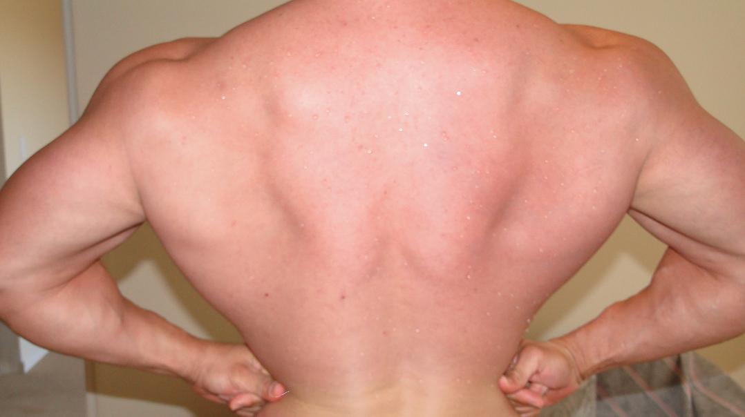 Back Lat Spread August 2009